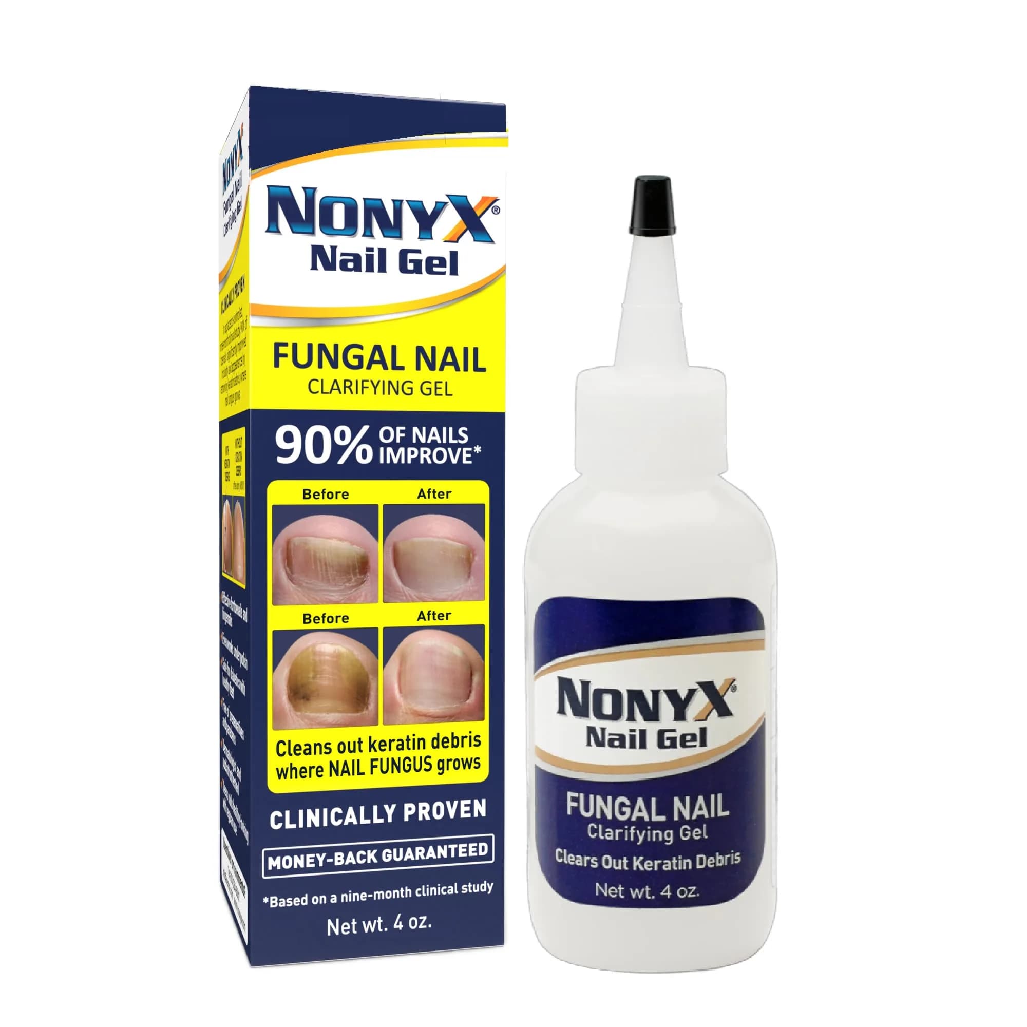 NONYX Fungal Nail Clarifying Gel 118ml (4 Fl Oz) | Clinically Proven to Improve Nail Appearance - main product image