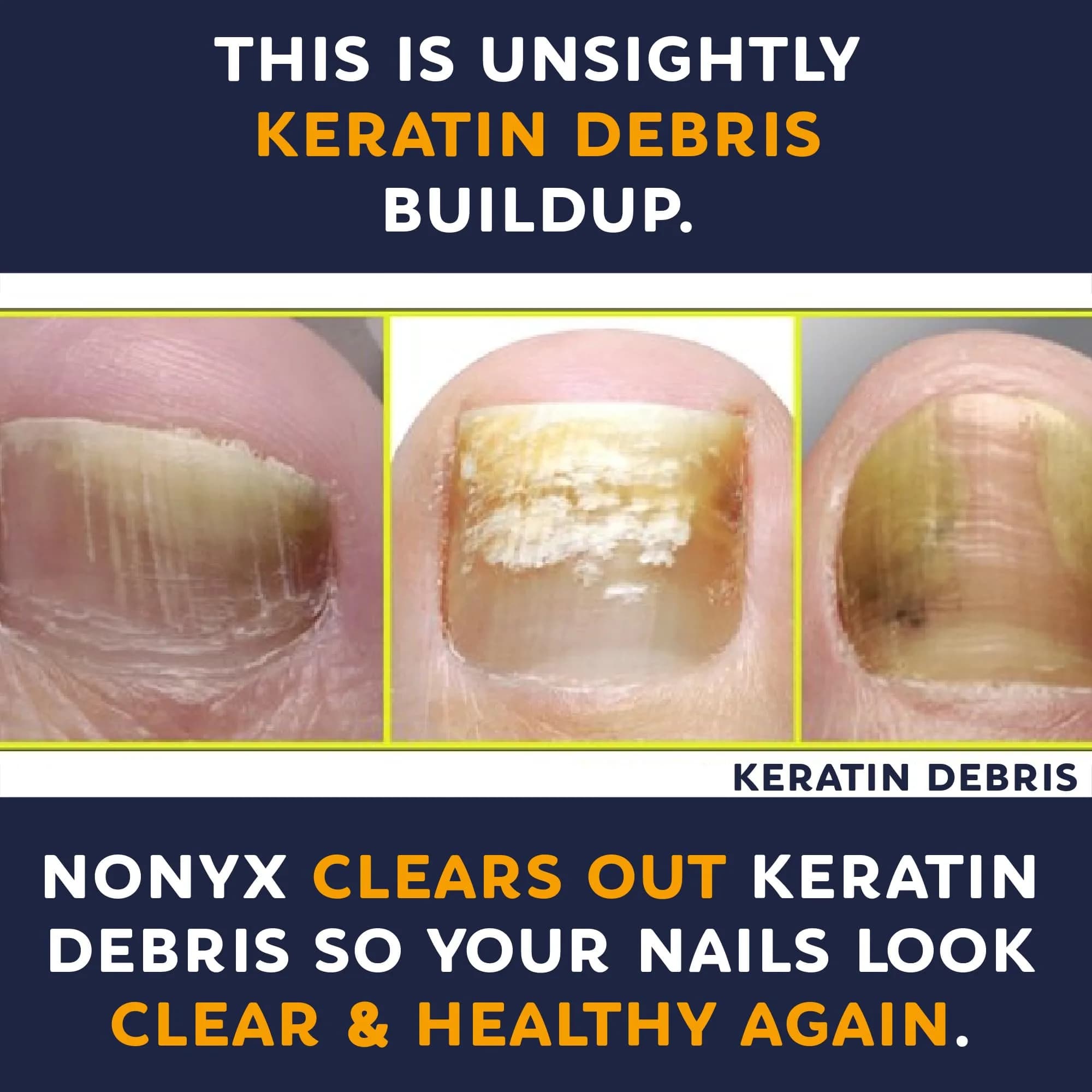 NONYX Fungal Nail Clarifying Gel 118ml (4 Fl Oz) | Clinically Proven to Improve Nail Appearance - view 7