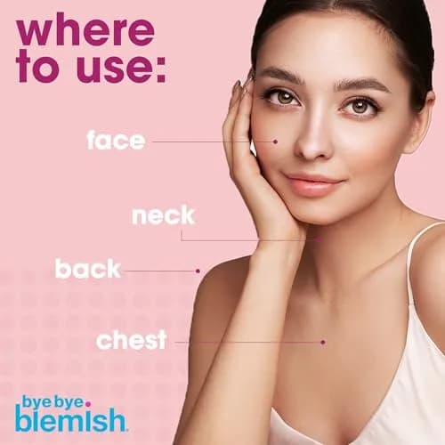 Bye Bye Blemish Drying Lotion 29.5ml | Rapid Pimple Reduction Overnight thumbnail 5