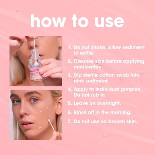 Bye Bye Blemish Drying Lotion 29.5ml | Rapid Pimple Reduction Overnight thumbnail 6