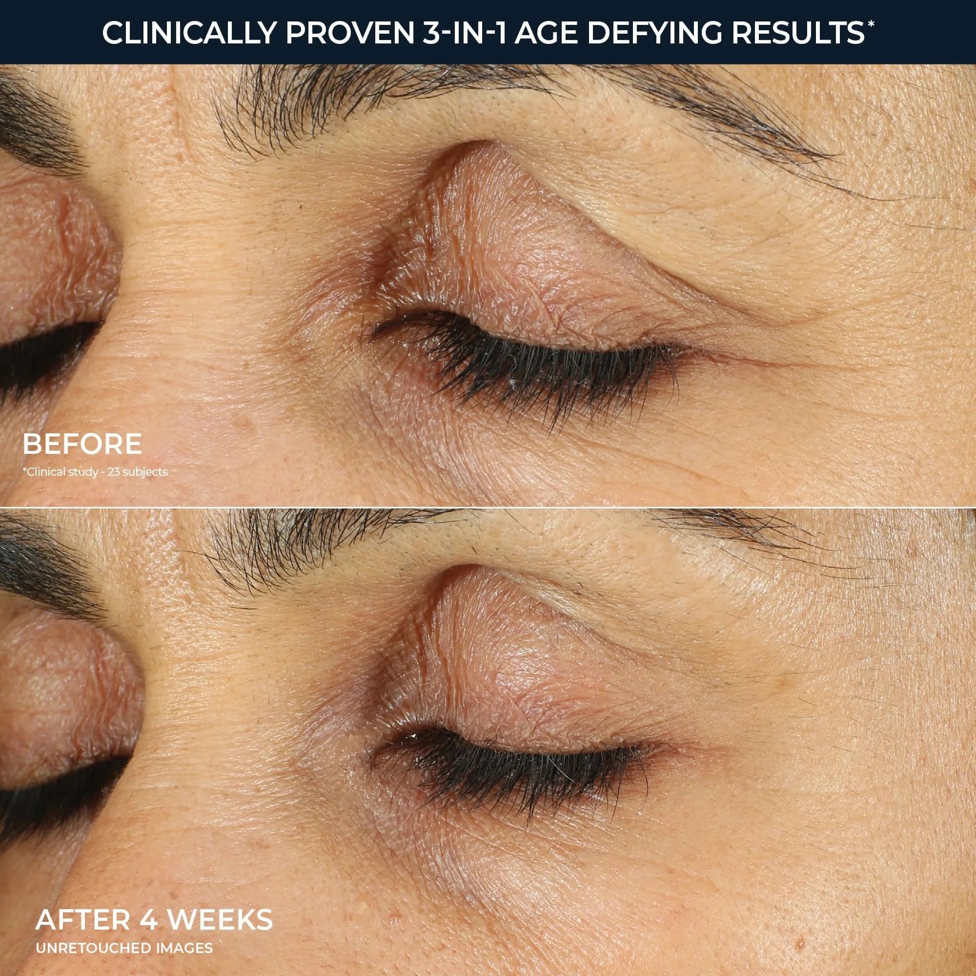 RoC Retinol Correxion Eye Cream | Targets Puffiness, Dark Circles & Wrines - view 4