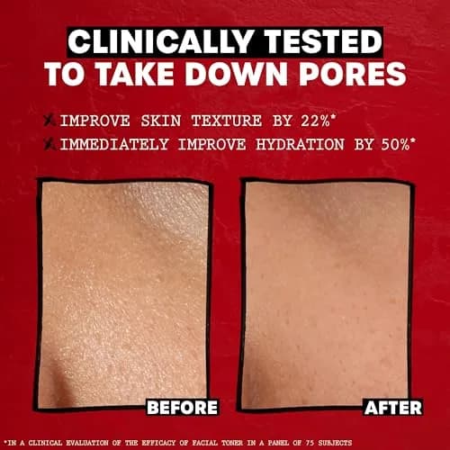 THAYERS Alcohol-Free Lavender Witch Hazel Facial Toner with Aloe Vera 355ml (12 Fl Oz) | Dermatologist Tested & Vegan thumbnail 7