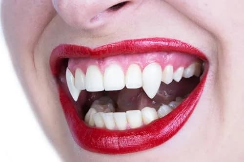 Scarecrow Small Deluxe Custom Fangs | Reusable, Realistic, Safe for Teeth thumbnail 3