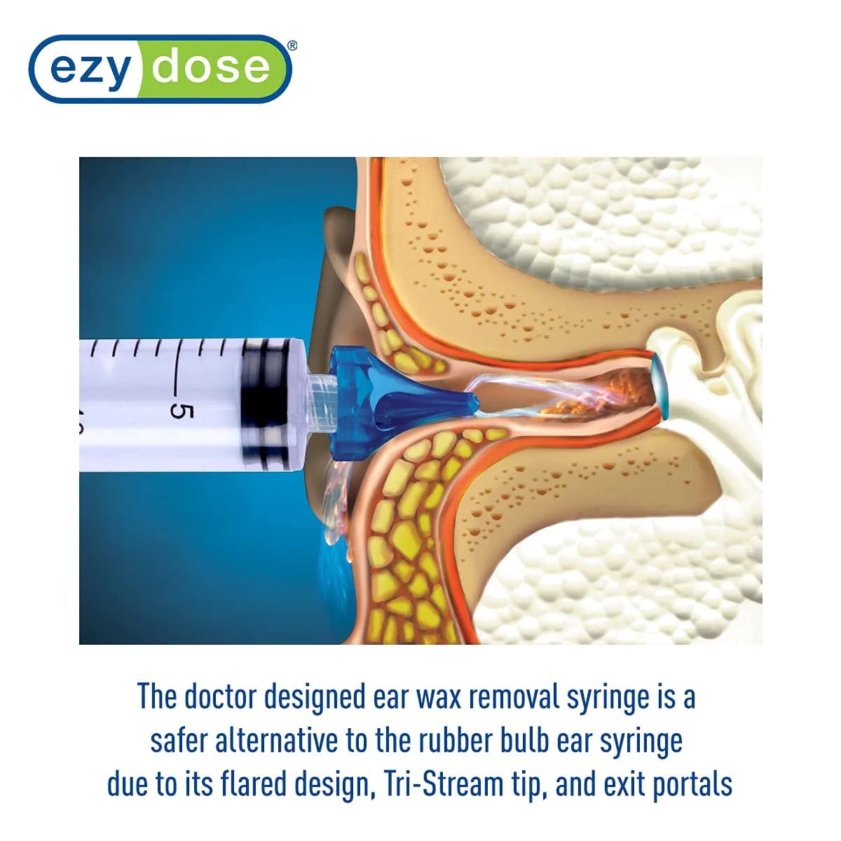 EZY DOSE Clear 20mL Ear Wax Removal Syringe | Doctor Designed Tri-Stream Tip - view 6