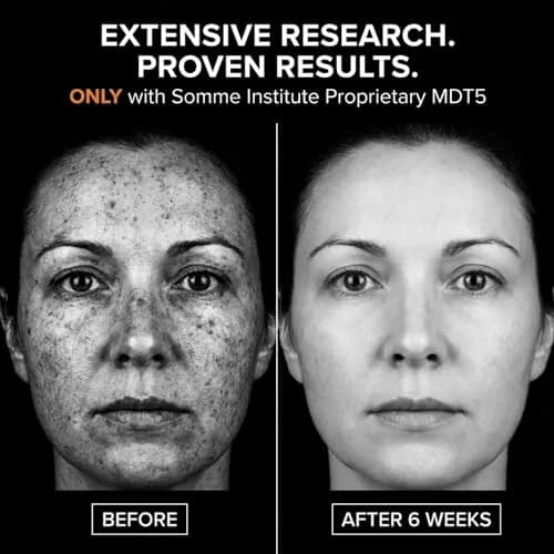 Somme Institute Alcohol-Free Skin Cleaning Wipe | Glycolic Acid Pads for Face & Pores | 50 Ct. thumbnail 4