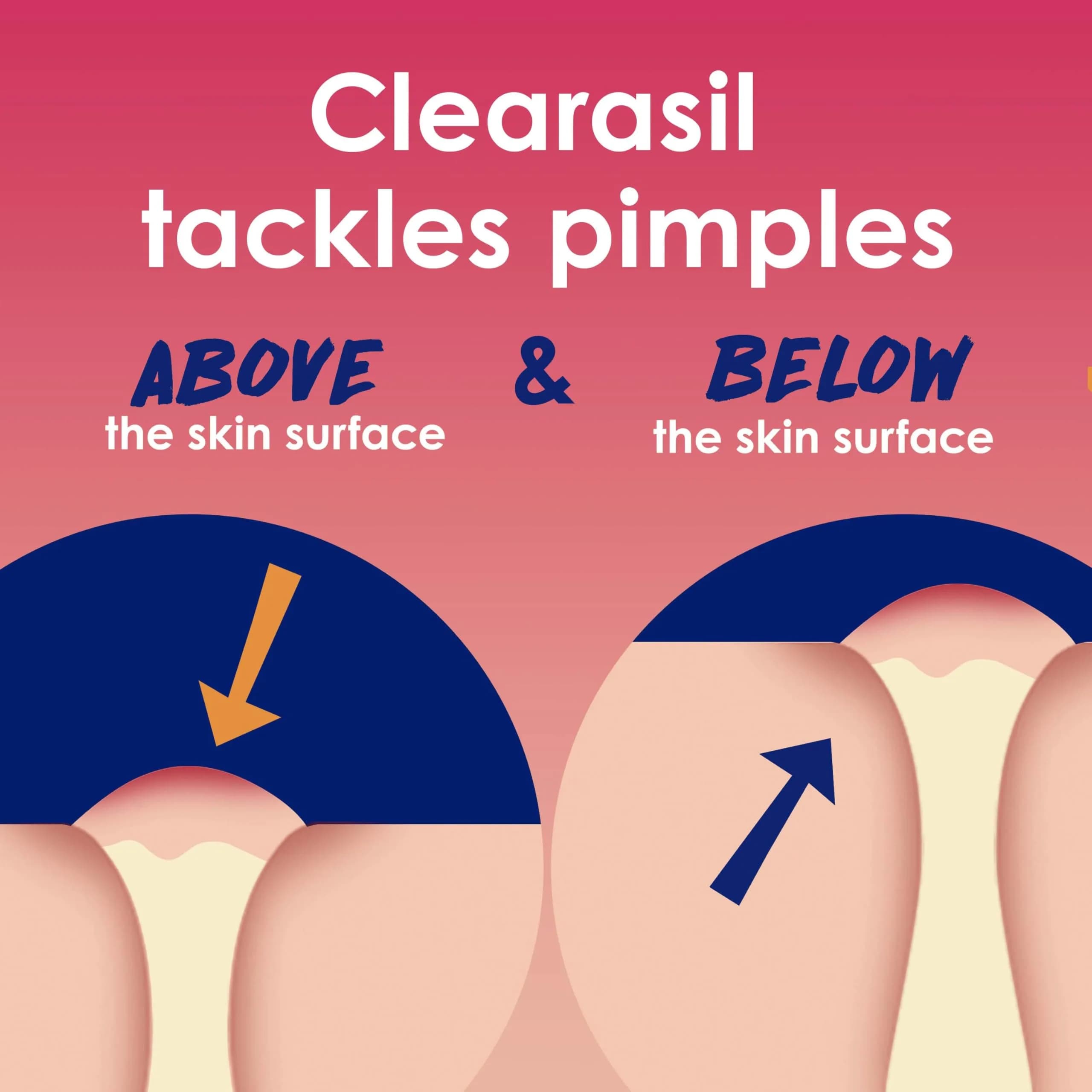 Clearasil Rapid Rescue Deep Treatment Acne Face Pads, Maximum Strength 2% Salicylic Acid, 90 Count - view 3