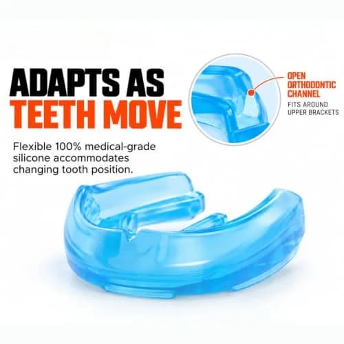 Shock Doctor Mouth Guard for Braces, Pink, Adult | Full Upper Teeth Protection for Braces & Sports thumbnail 4