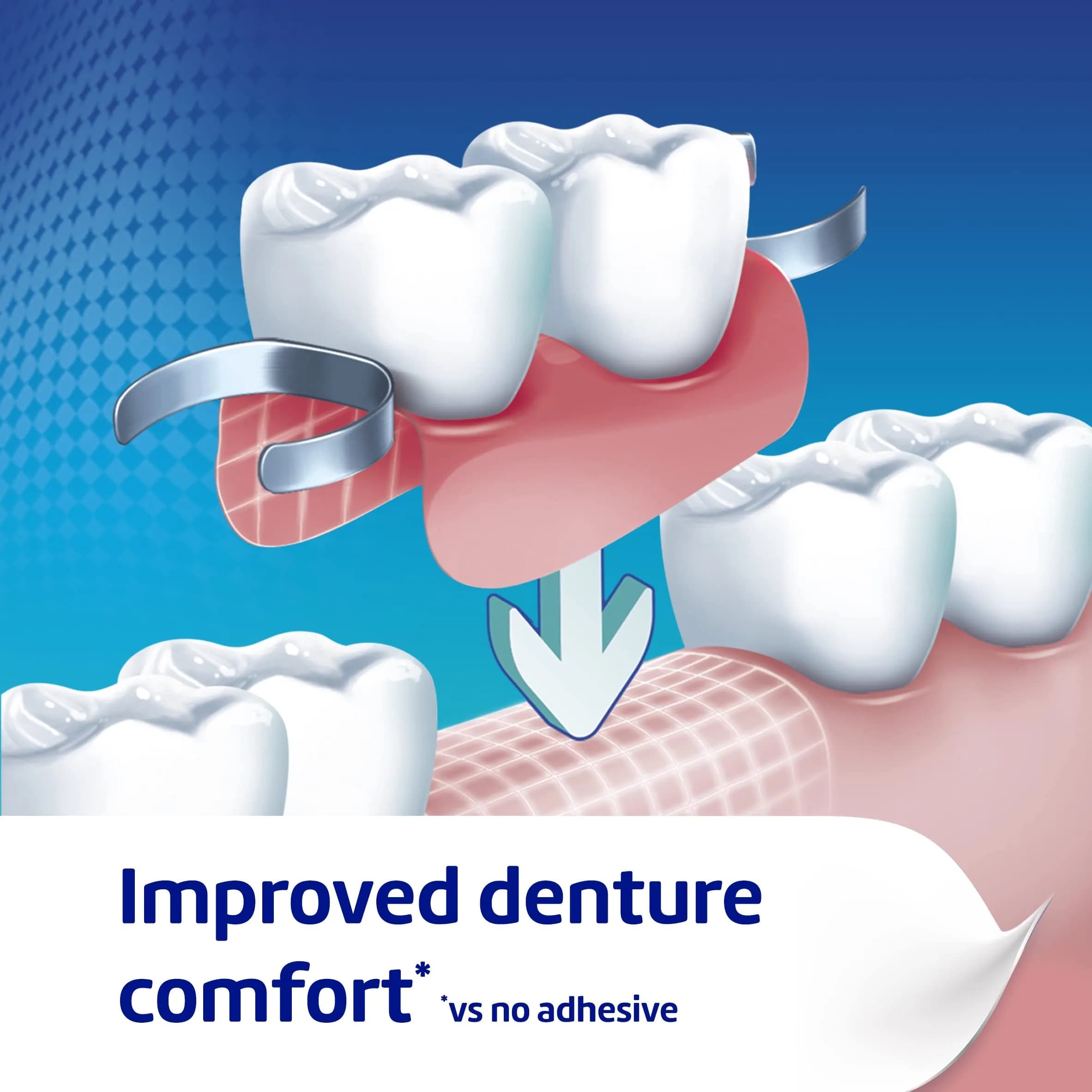 Poligrip Denture Adhesive Cream Ultra Fresh Mint 40g (1.41 oz) | Strong All-Day Hold - view 4