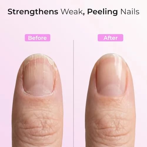 Orly Nail Rescue Kit | Repairs Cracked, Broken Nails | Compact Kit with Nail Glue, Powder & Buffer for Flawless Nails thumbnail 2