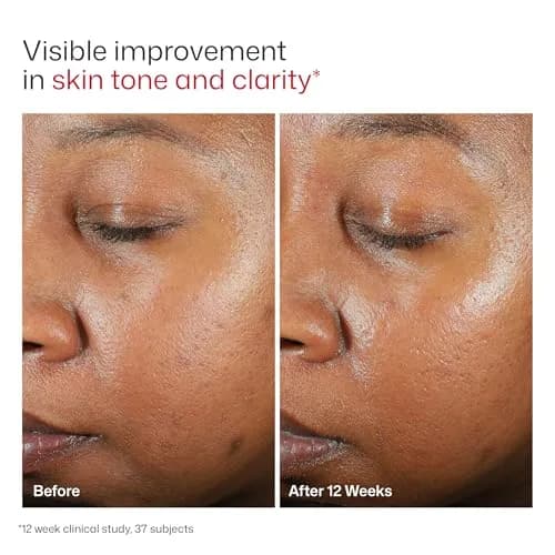 EltaMD UV Clear Untinted Face Sunscreen SPF 46 50ml (1.7 Fl Oz) | Calms and Protects Acne-Prone Skin thumbnail 8