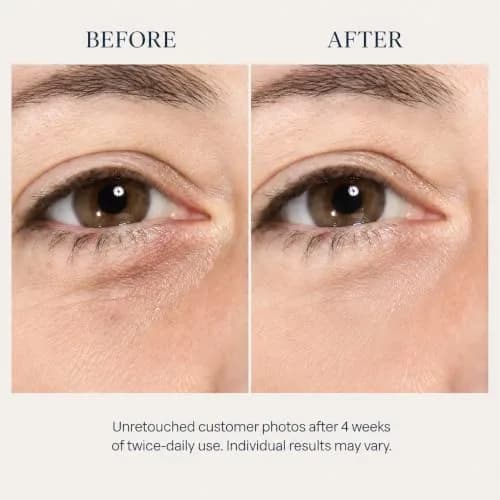 Osmotics Cosmeceuticals Under Eye Rejuvenator 15ml | Peptide Serum for Dark Circles & Puffiness thumbnail 4