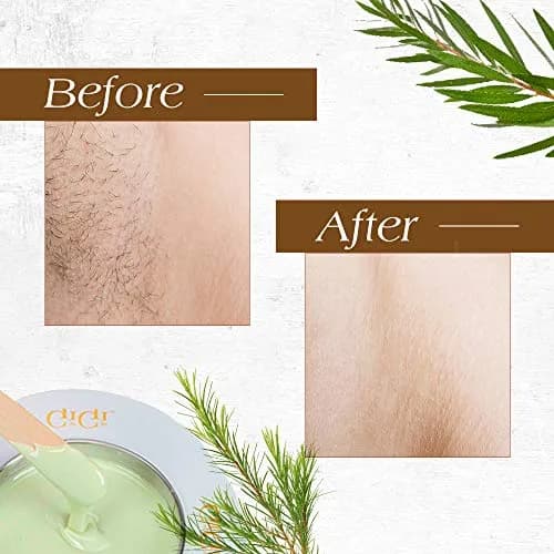GiGi Tea Tree Crème Wax for Sensitive Skin, Face & Body, 396g (14 oz) | Gentle Hair Removal thumbnail 3