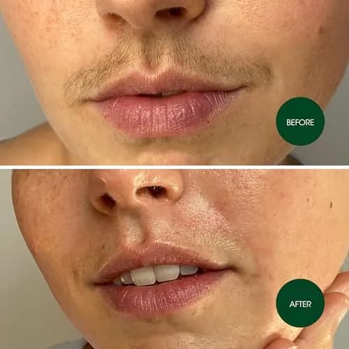 Nad's Hypoallergenic Facial Wax Strips for Women | 20 Strips + 4 Calming Wipes thumbnail 5