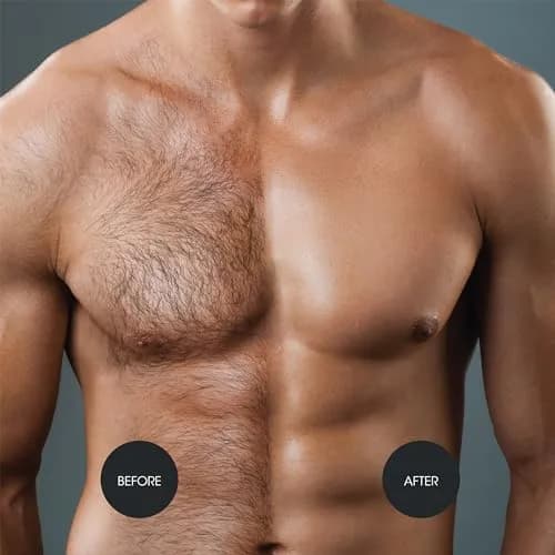 Nad's For Men Hair Removal Cream 200ml (6.8 Fl Oz) | Painless Depilatory for Coarse Male Body Hair thumbnail 4