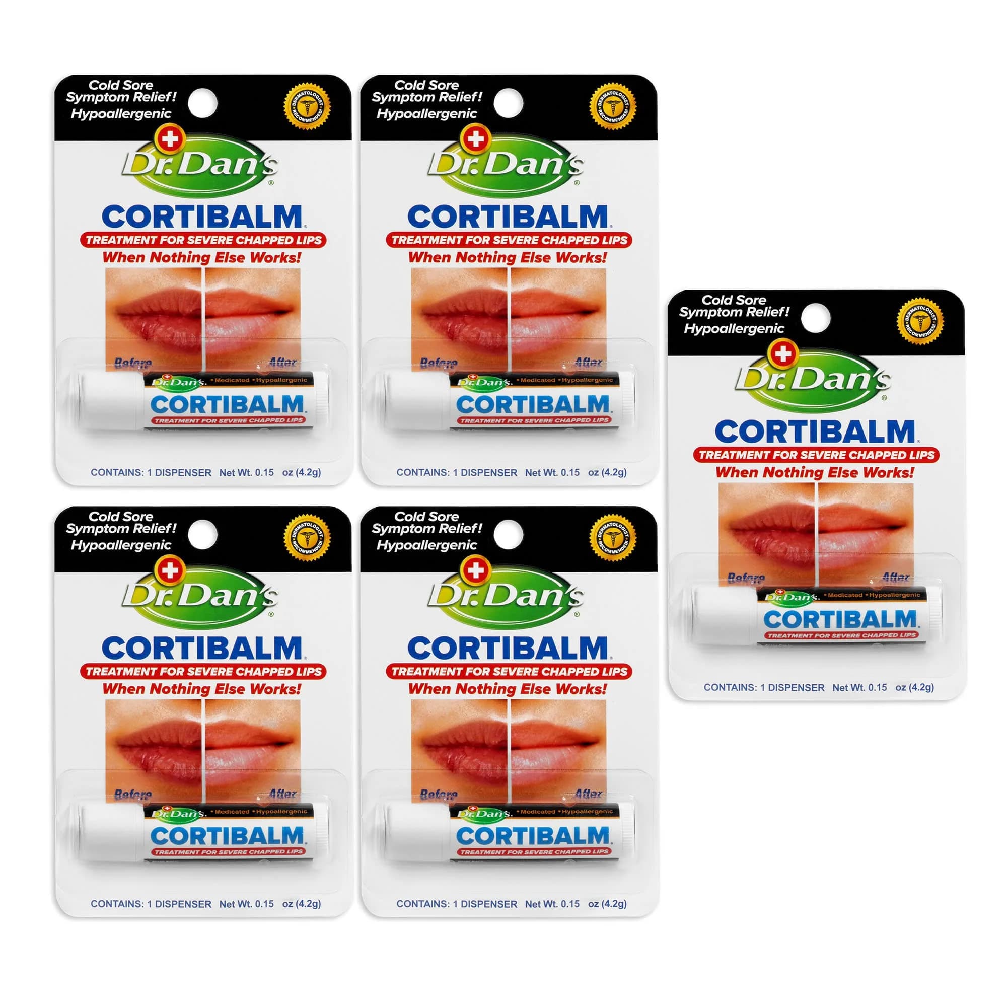 Dr. Dan's Cortibalm Lip Balm 5 Pack 1% Hydrocortisone for Dry Lips | Healing & Nourishing — Cream White