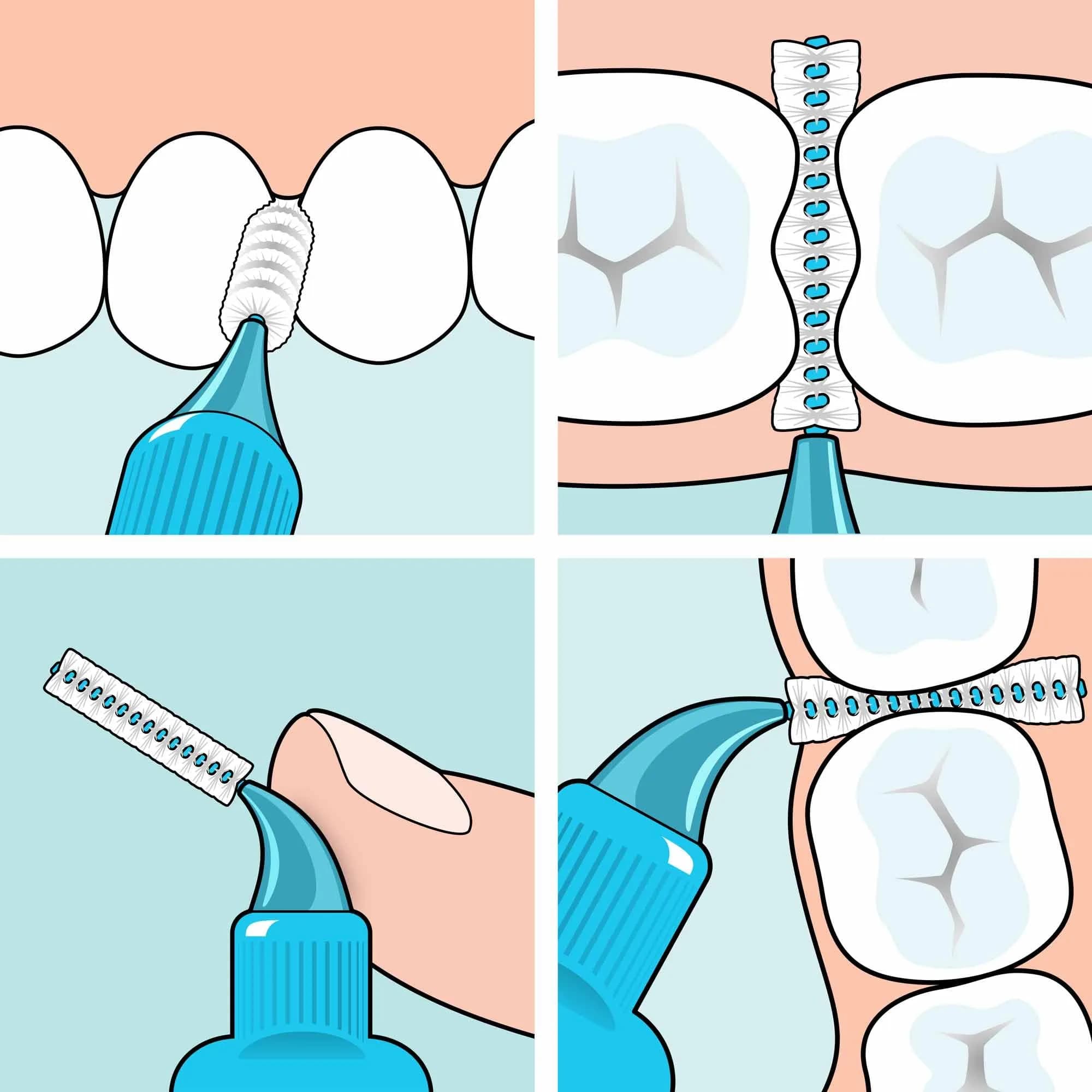TePe Extra Soft Interdental Brush 0.45 mm (8 Count) | Developed with Dental Experts for Gentle Cleaning - view 4