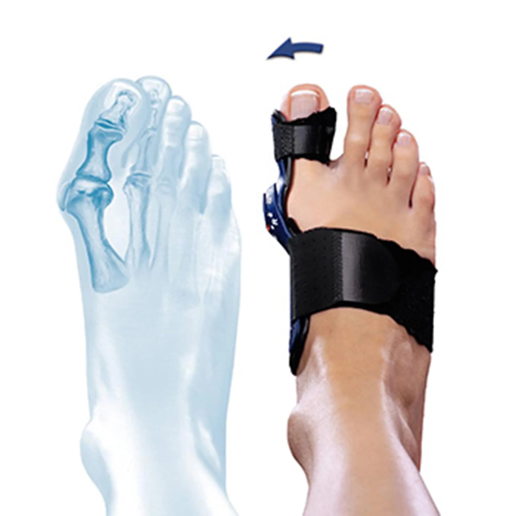 Bauerfeind II Splint for Valgus Bunion Splint Black Universal Size | FDA Approved Medical Grade Support - view 3