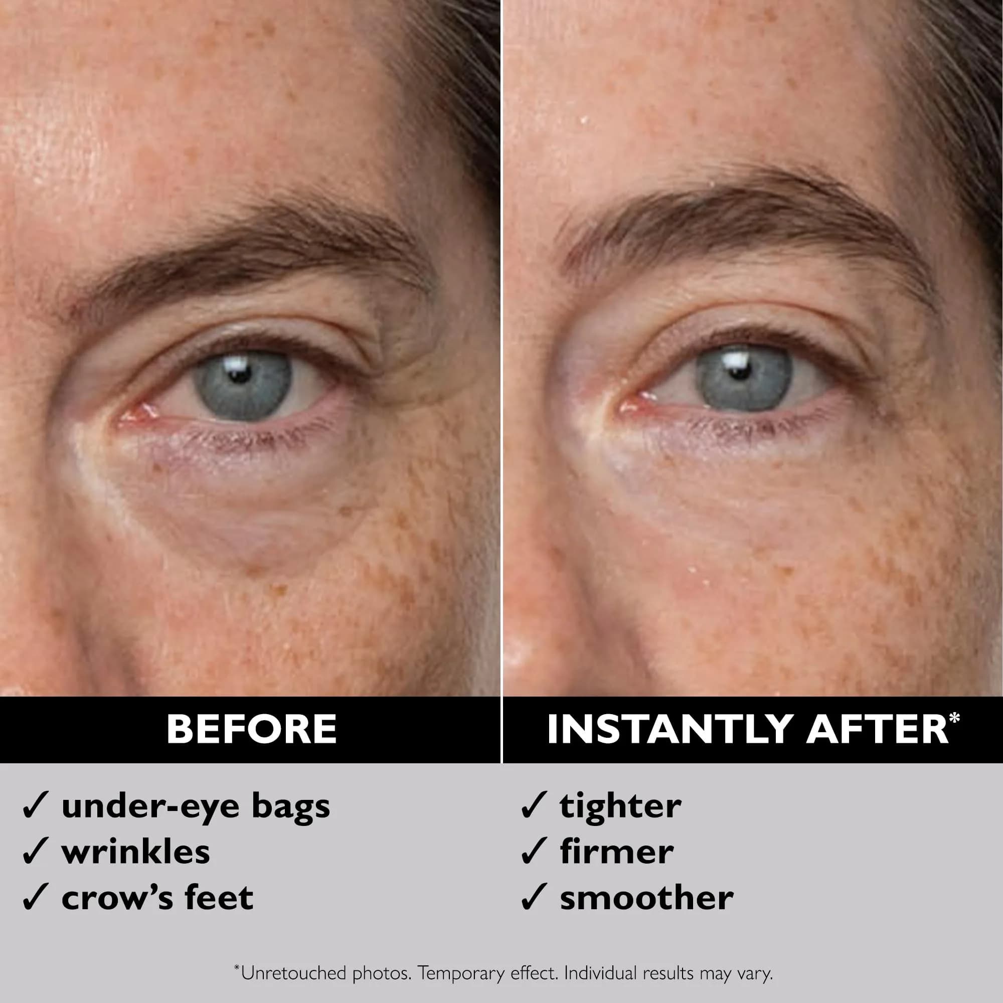 Peter Thomas Roth Instant FIRMx® Eye Temporary Eye Tightener 30ml (1 Fl Oz) | Ophthalmologist-Tested for Instant Firmness - view 3
