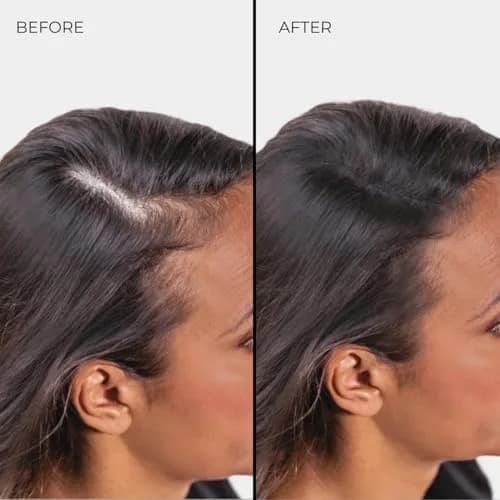 Nanogen Hair Thickening Keratin Fibres Medium Brown | Instant Volume & Density (70-120 chars) thumbnail 10