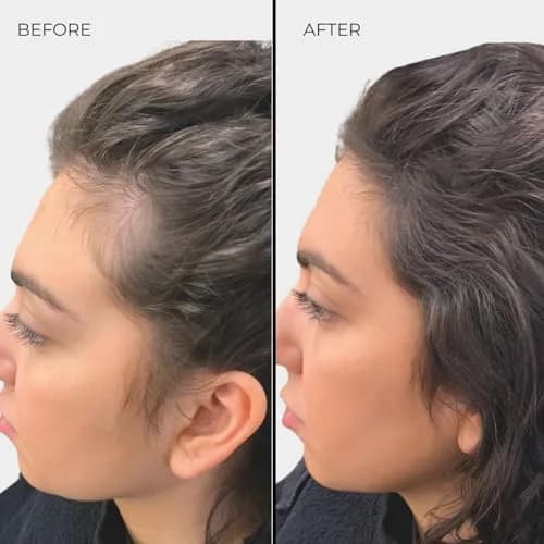 Nanogen Hair Thickening Keratin Fibres Medium Brown | Instant Volume & Density (70-120 chars) thumbnail 4