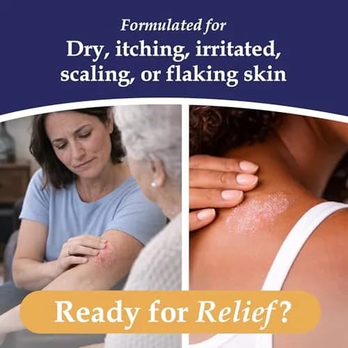 Noble Formula 2% Pyrithione Zinc Bar Soap for Flaky, Itchy Skin | Gentle, All Skin Types, 3.25 oz thumbnail 2