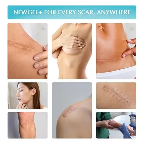 MyNewGel Medical-Grade Silicone Scar Gel with Vitamin E, 0.5 oz | Fast-Drying, Non-Toxic Scar Treatment thumbnail 8