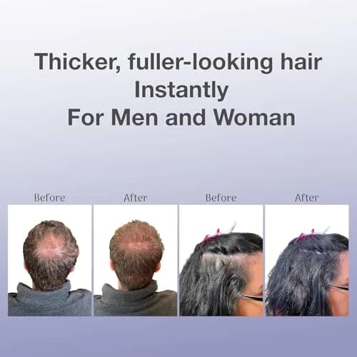 BosleyMD BOSVolumize Hair Thickening Fibers – Natural Keratin Formula for Thinning Hair & Bald Spots – Instant Fuller, Thicker Look – Wind & Sweat Resistant – Medium Brown, 0.42 oz thumbnail 5
