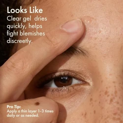 Origins Spot Treatment for Acne | Salicylic Acid 0.34 Fl Oz | Clear Pimples & Blackheads thumbnail 5