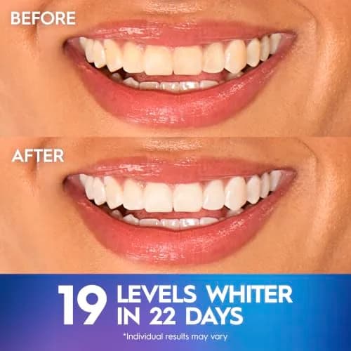 Crest 3D Whitestrips Professional Effects Teeth Whitening Kit 44 Strips (22 Treatments) | Dentist Recommended thumbnail 4