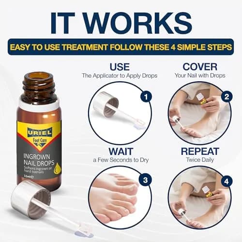 URIEL Ingrown Toenail Treatment 11 ml | Supports Nail Health & Comfort for Home Use thumbnail 4