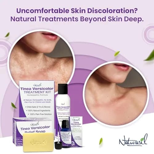 Naturasil Tinea Versicolor Treatment Sulfur Soap 2 Pack | Natural Antifungal Relief for Skin Discoloration thumbnail 2