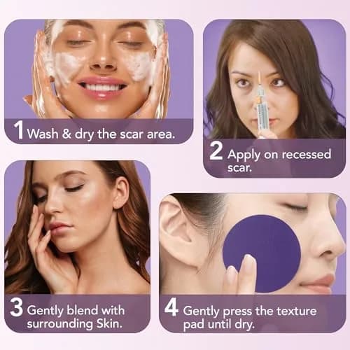 Dermaflage Scar Filler Kit Bronze Medium Waterproof Concealer for Acne Scars Wrinkles Ice Pick Scars Makeup | 1 mo supply thumbnail 4