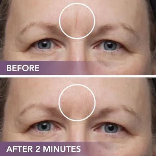 Dermaflage Scar Filler Kit - Deep Skin Tone Waterproof Concealer for Acne & Wrinkles, 1 Count thumbnail 8