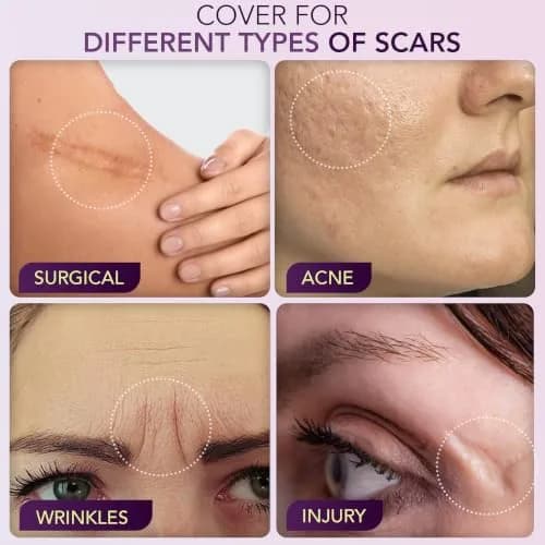 Dermaflage Scar Filler Kit - Deep Skin Tone Waterproof Concealer for Acne & Wrinkles, 1 Count thumbnail 4
