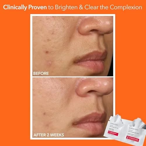 Dr Dennis Gross Alpha Beta Extra Strength Exfoliating Daily Peel - 60 Pack | Professional Results at Home thumbnail 4