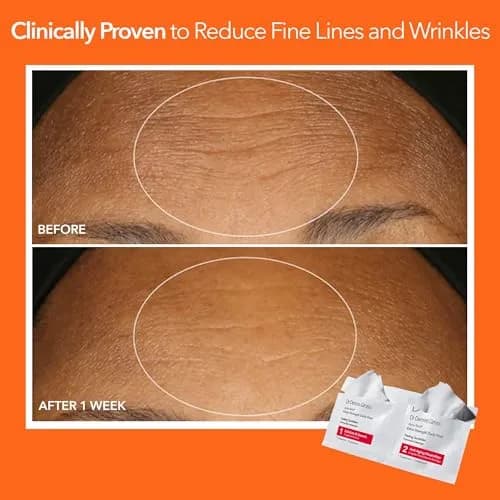Dr Dennis Gross Alpha Beta Extra Strength Exfoliating Daily Peel - 60 Pack | Professional Results at Home thumbnail 6