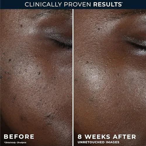 RoC Multi Correxion Restoring Night Cream 50.3 ml (1.7 fl oz) | Targets Discoloration & Fine Lines thumbnail 5