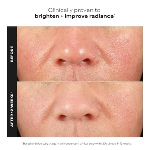 Paula's Choice C15 Super Booster Vitamin C Serum 20ml (0.67 Fl Oz) | Brightens Skin & Boosts Glow thumbnail 2
