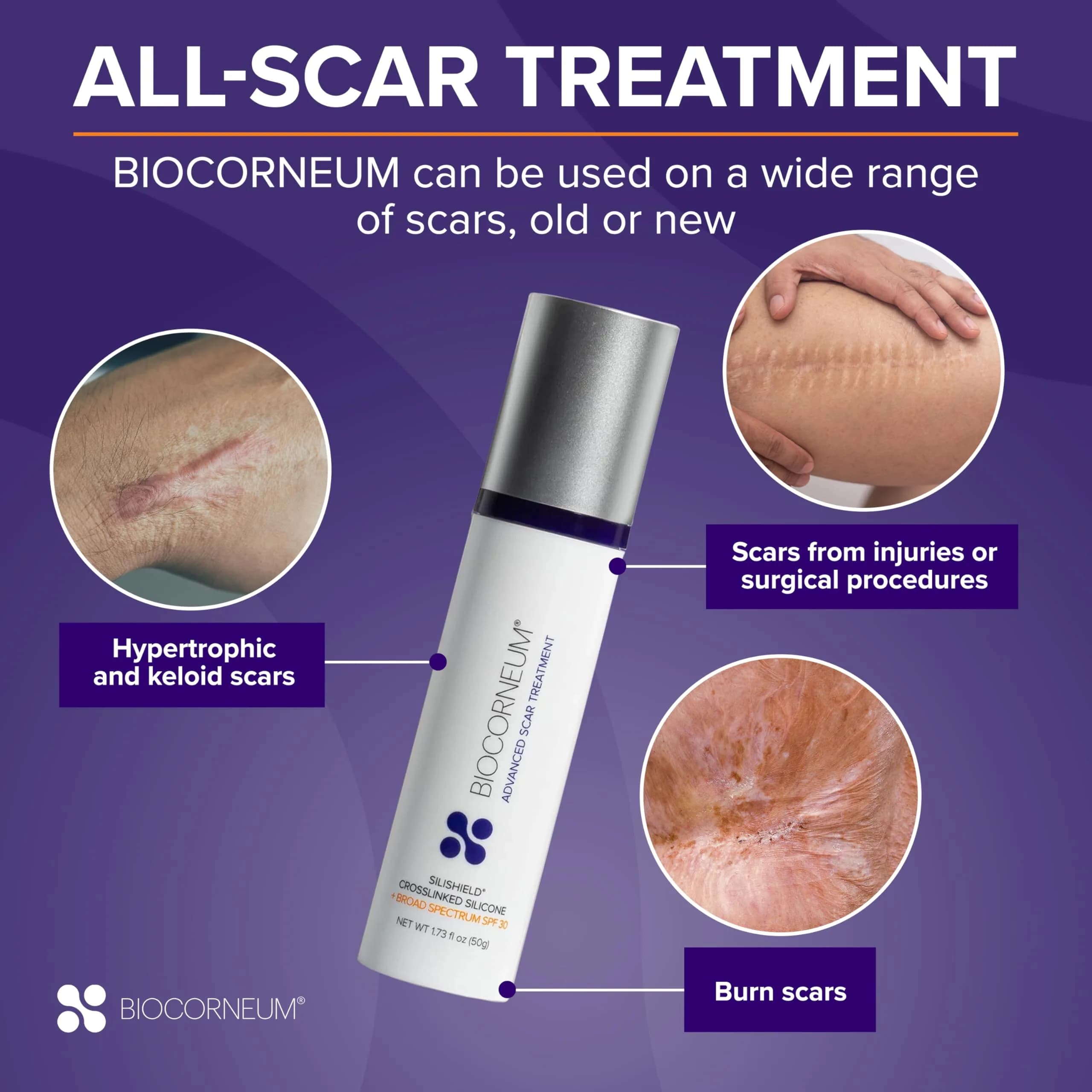 Biocorneum Advanced Scar Treatment with Silishield & SPF 30 (10g / 0.35oz) | Medical Grade Silicone Gel for Surgical Scars - view 5