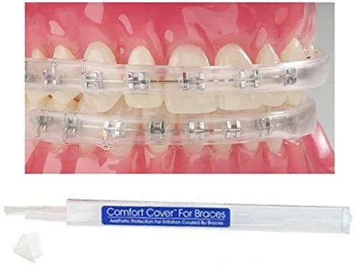 Sonic Dental Comfort Guard Mouth Guard for Braces | Orthodontic Lip Shield Relief thumbnail 1