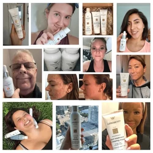 Gunilla Of Sweden LEROSETT Healing Hydration Serum for Pimples & Irritated Skin, Vegan, 1 oz | Supports Skin Healing & Moisturization thumbnail 5
