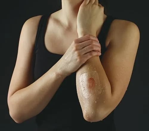 Nexcare Tegaderm Transparent Dressing, Clear Film | Waterproof, Breathable, 7-Day Wear, 10 Dressings thumbnail 8