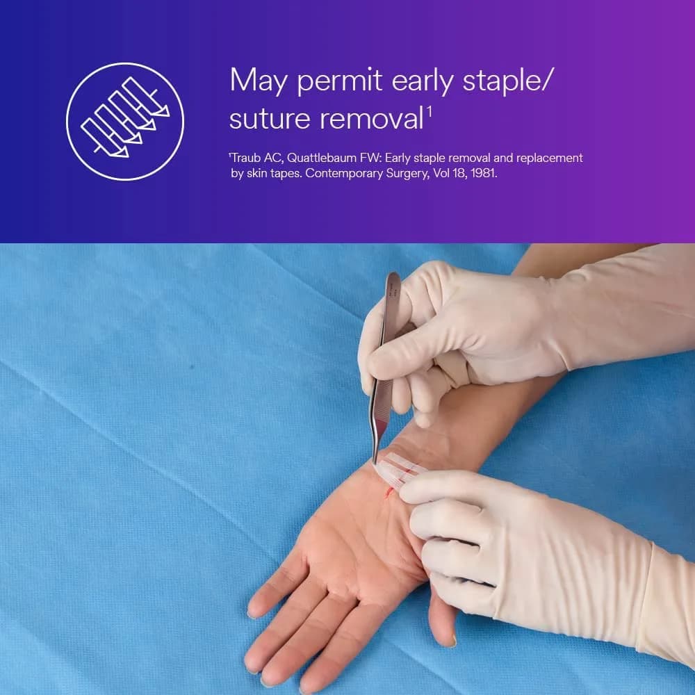 3M Steri-Strip Reinforced Adhesive Skin Closures 6 mm x 100 mm (1/4 in x 4 in) | Hypoallergenic Wound Dressing - view 4