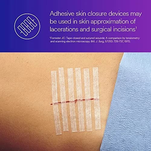 3M Steri-Strip Reinforced Adhesive Skin Closures 6 mm x 100 mm (1/4 in x 4 in) | Hypoallergenic Wound Dressing thumbnail 5