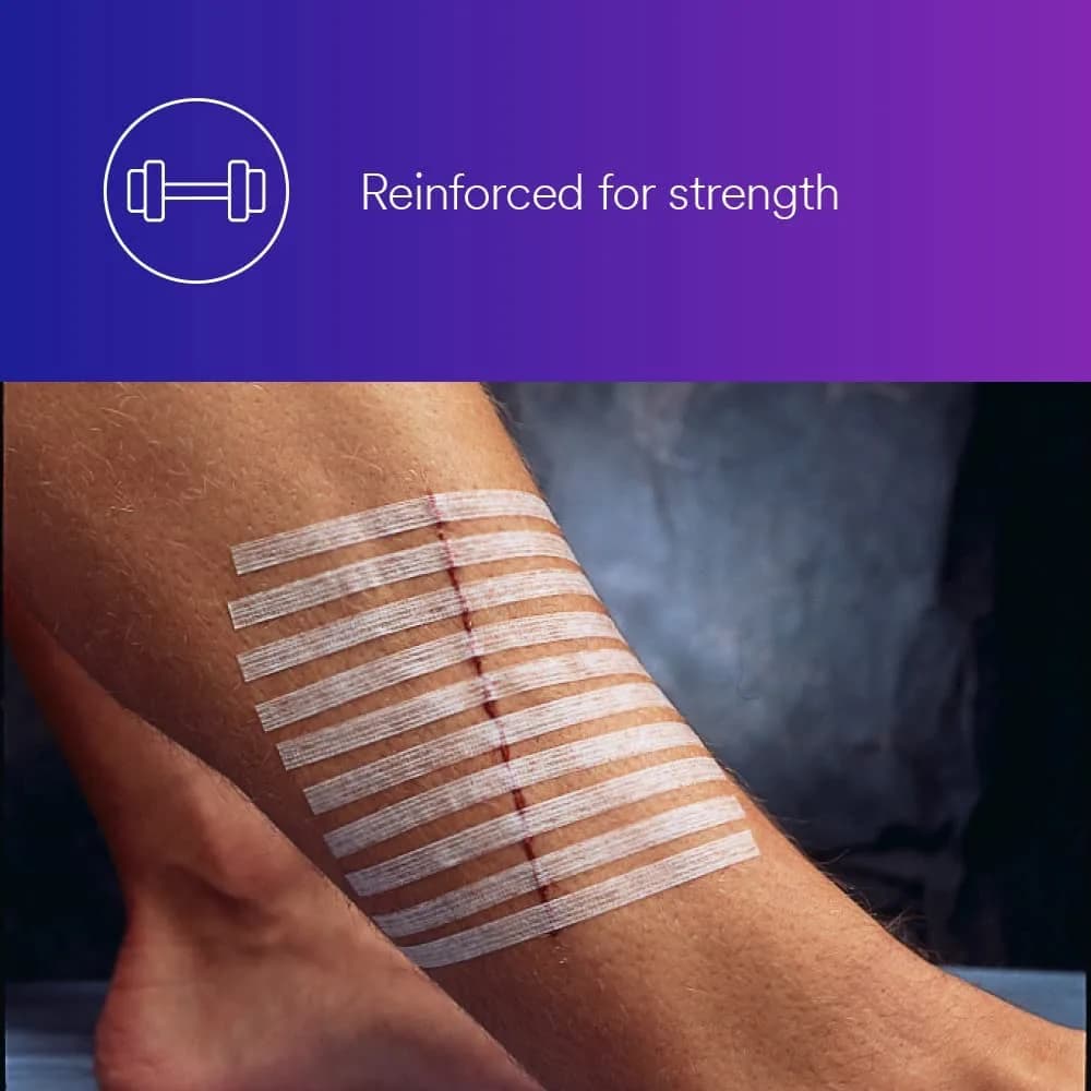 3M Steri-Strip Reinforced Adhesive Skin Closures 6 mm x 100 mm (1/4 in x 4 in) | Hypoallergenic Wound Dressing - view 2