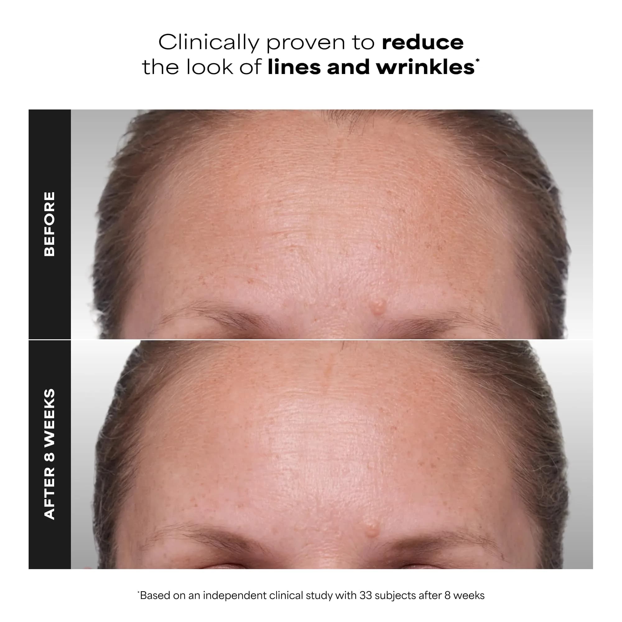 Paula's Choice CLINICAL 1% Retinol Treatment Cream 5 ml (0.17 Fl Oz) | Potent Anti-Aging & Wrinkle Reduction - view 3