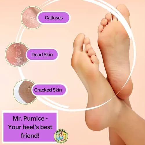 Mr. Pumice PUMI Bar Foot Callus Remover, Extra-Coarse, Purple, 4 Count | Dead Skin & Callus Smoother thumbnail 2