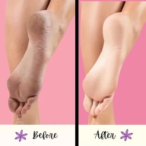Mr. Pumice PUMI Bar Foot Callus Remover, Extra-Coarse, Purple, 4 Count | Dead Skin & Callus Smoother thumbnail 3