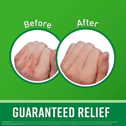 O'Keeffe's Working Hands Hand Cream & Healthy Feet Foot Cream Combo Pack 100.6g (3.4 oz + 3.2 oz) | Intensive Dry Skin Repair thumbnail 2