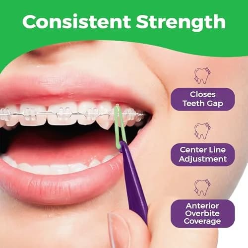 Prairie Horse Supply Orthodontic Rubber Bands for Braces, 1/4in Medium, 300 Pack | Versatile & Durable thumbnail 4